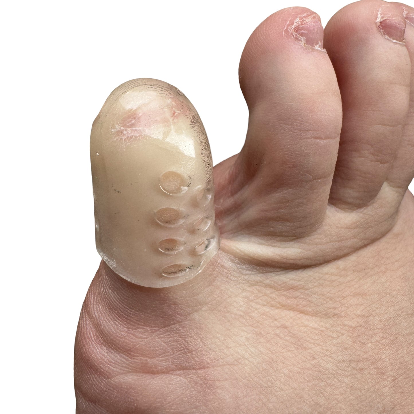 Silicone Toe or Finger Protector